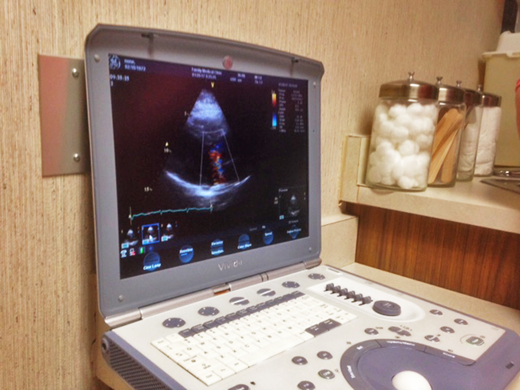 A portable ultrasound machine shows an image of a patient’s heart function in an exam room at Family Medical Clinic on Thursday, Jan. 26, 2017 in Soldotna, Alaska. The clinic recently began a heart health program called Heartwise, which offers comprehensive screenings for conditions such as stroke, diabetes, varicose veins and other cardiac diseases. (Elizabeth Earl/Peninsula Clarion)