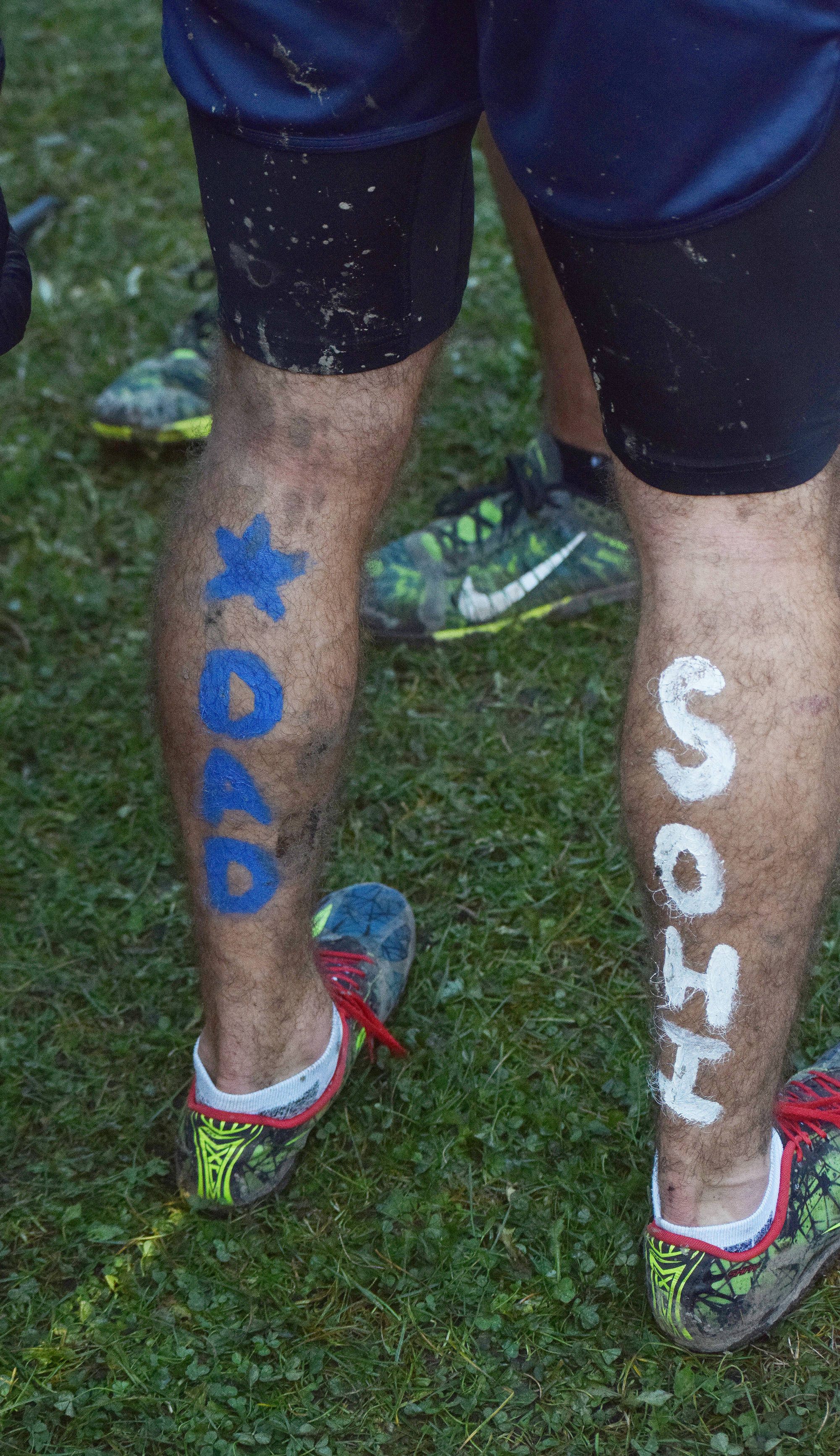 Body paint decorates the calves of Soldotna’s Koby Vinson after the Division I boys race Saturday at the ASAA First National Bank Alaska Cross-country State Championships at Bartlett High School. (Photo by Joey Klecka/Peninsula Clarion)