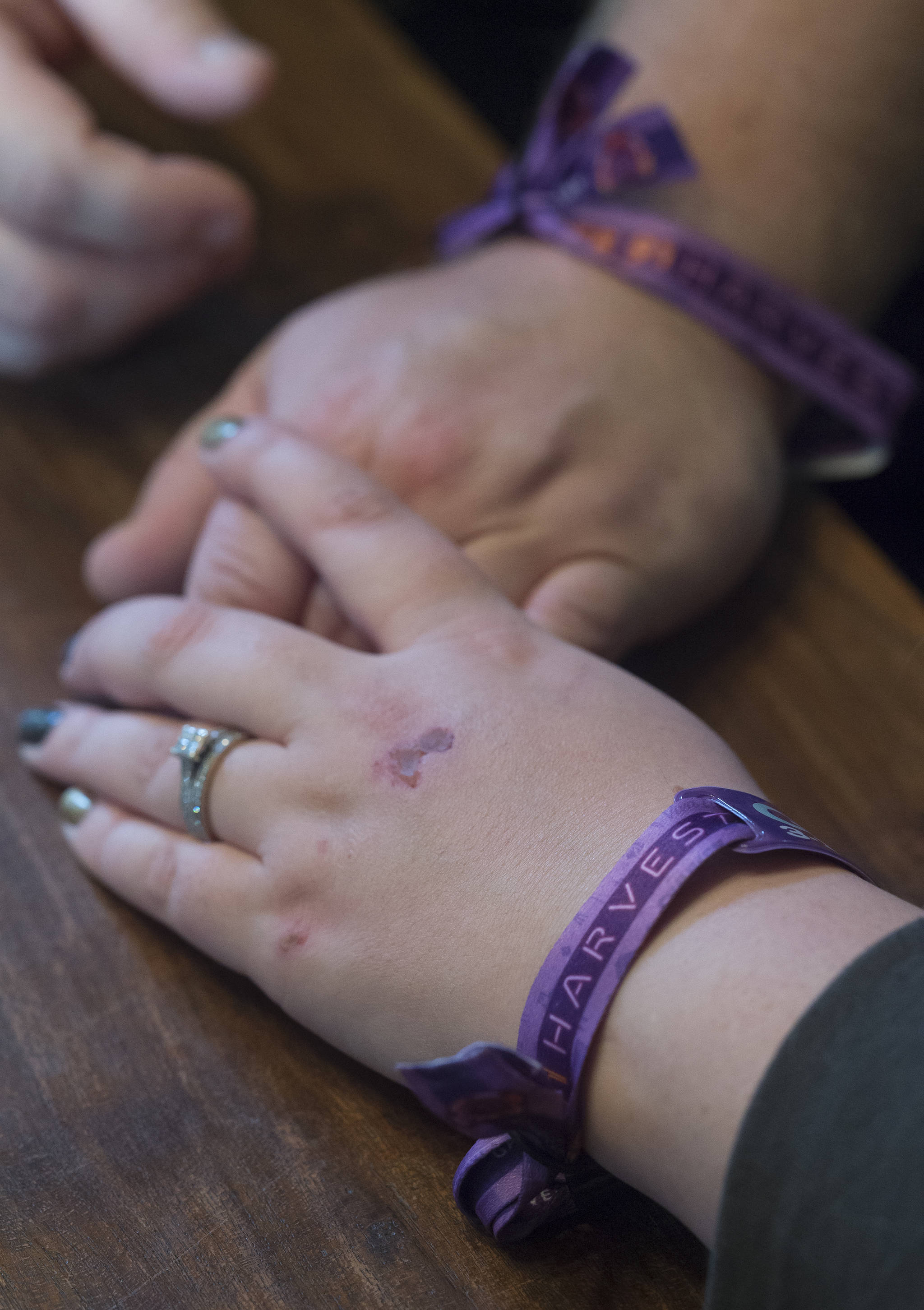 Hilary Rehfield-Green and her husband, Ryan Green, continue to wear the admission bands from the Route 91 Harvest Music Festival after returning to Juneau having survived the shooting spree over the weekend. (Michael Penn | Juneau Empire)