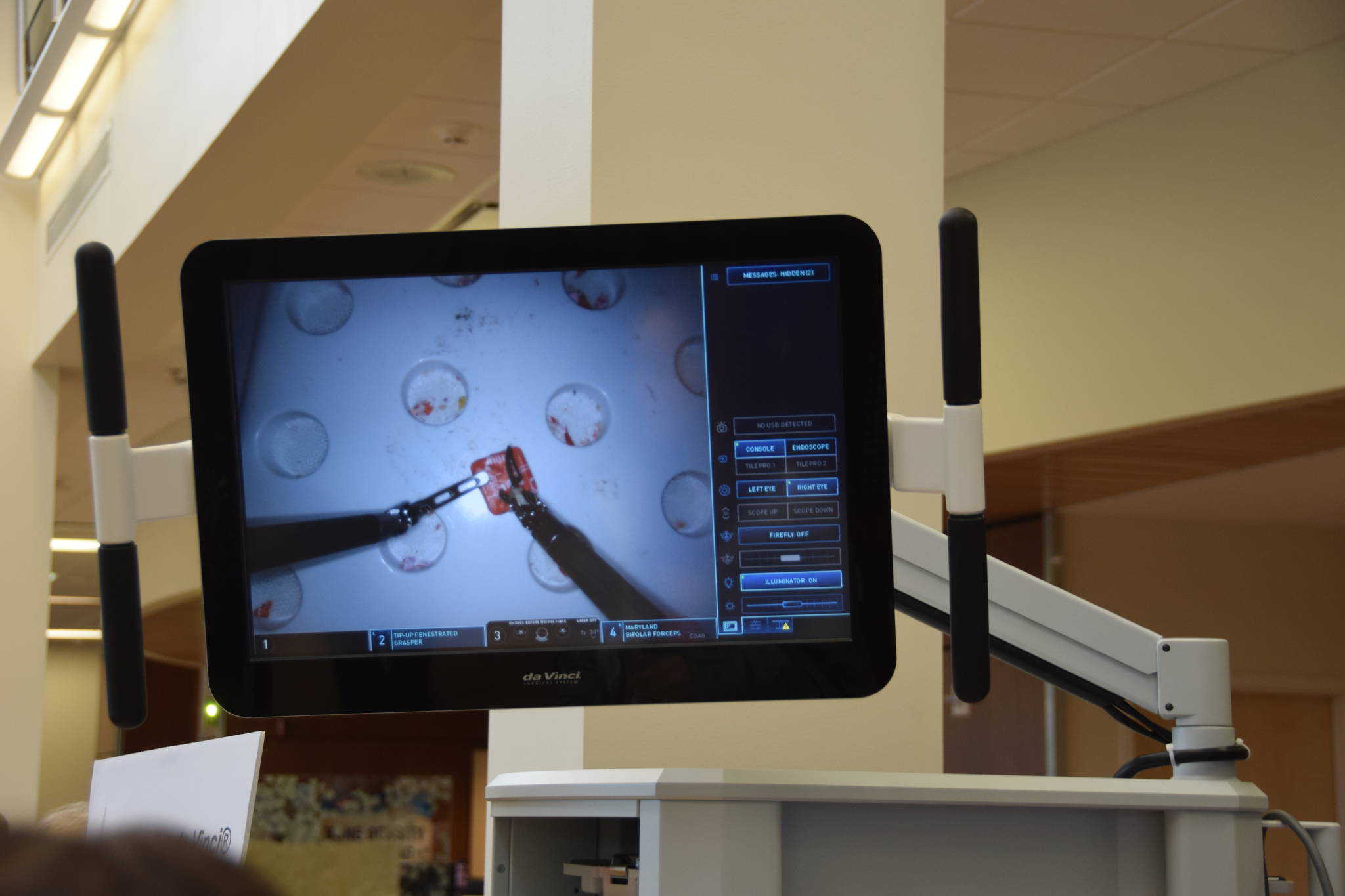 The Da Vinci Xi’s monitor shows what the surgeon sees during procedures so that others can follow along, as seen during the Community Health Fair at Central Peninsula Hospital in Soldotna, Alaska, on March 23, 2019. (Photo by Brian Mazurek/Peninsula Clarion)