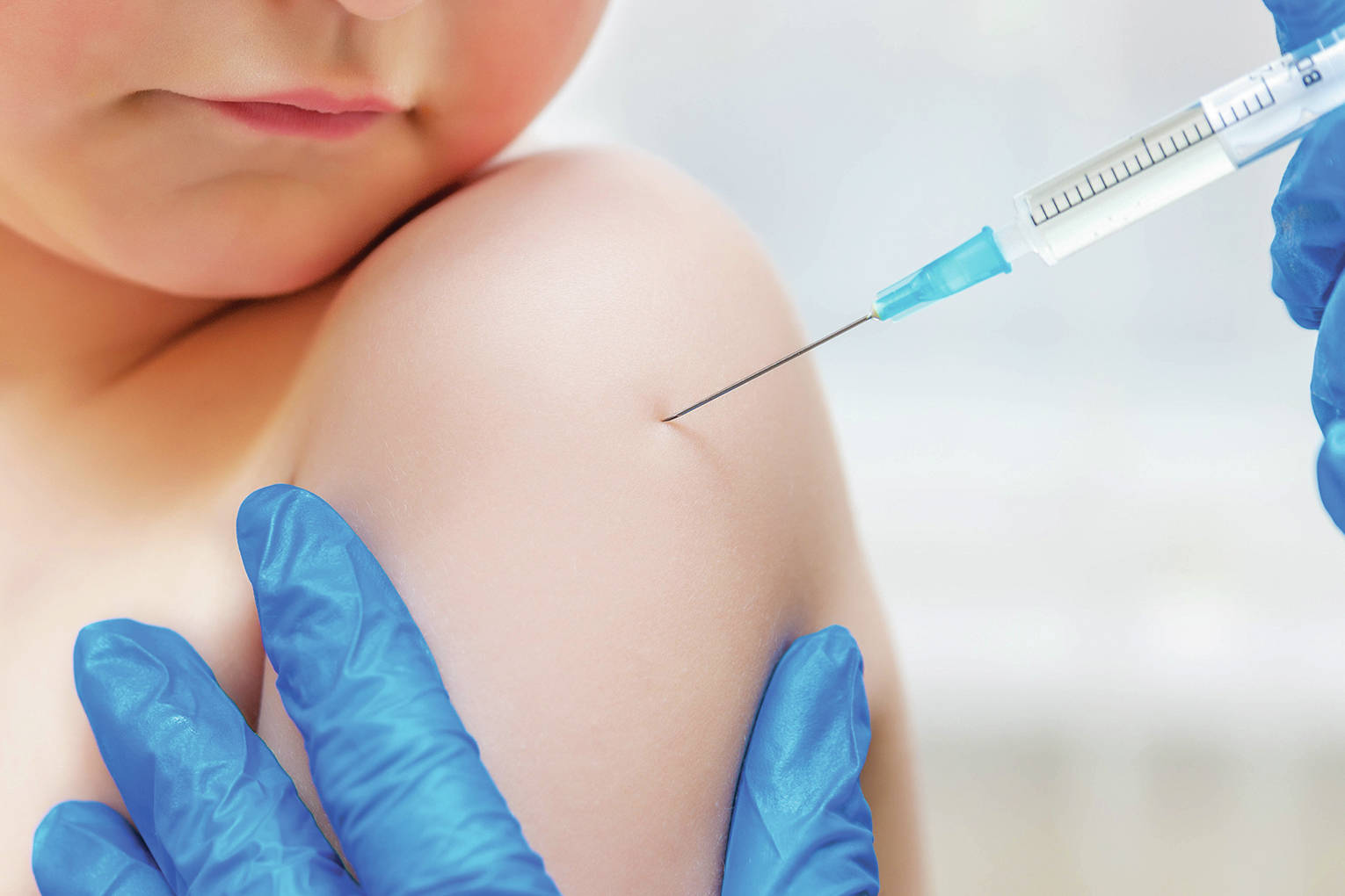 Opinion: The national measles outbreak has spread to Alaska — Please get vaccinated!