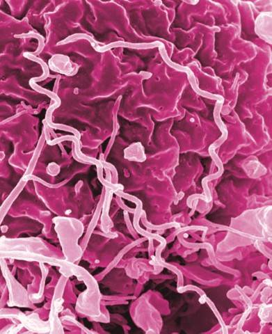 This image shows treponema pallidum, the bacteria that cause syphilis. (Courtesy Photo / NIAID)