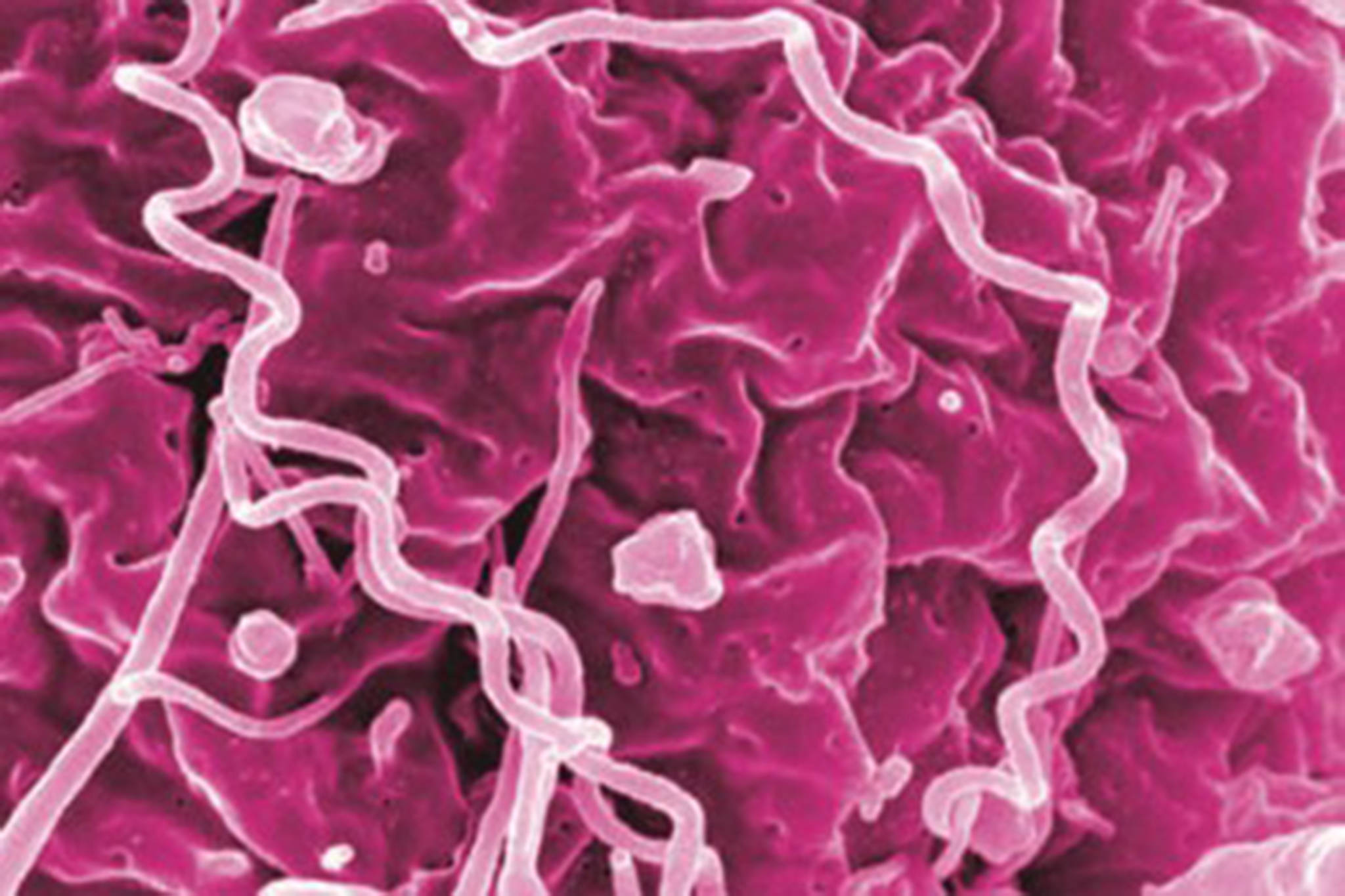 This image shows treponema pallidum, the bacteria that cause syphilis. (Courtesy Photo / NIAID)