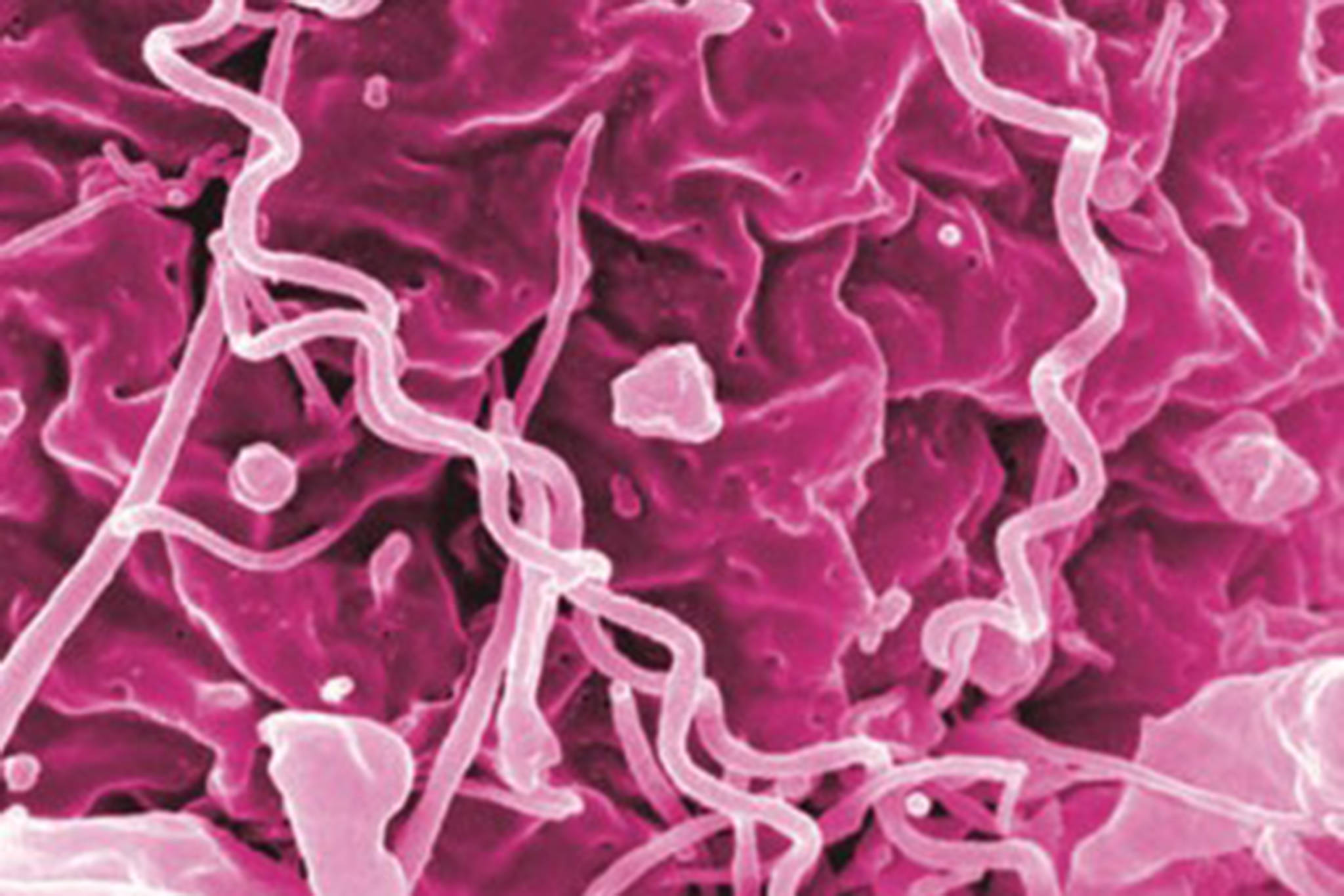 This image shows treponema pallidum, the bacteria that cause syphilis. Alaska's syphilis infection rates increased by 49% over 2019 numbers, the Department of Health and Social Services reported this week. (Courtesy Photo / NIAID)