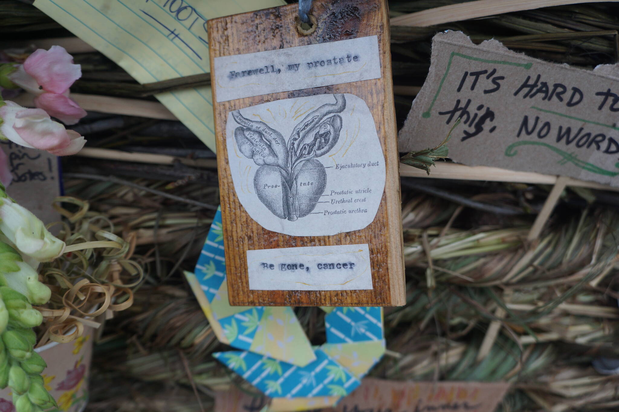 This art work placed Sept. 11, 2022, on “Breathe,” the 2022 Burning Basket in Homer, Alaska, expressed the author’s hope that his prostate surgery would remove the cancer from his body. (Photo by Michael Armstrong/Homer News)