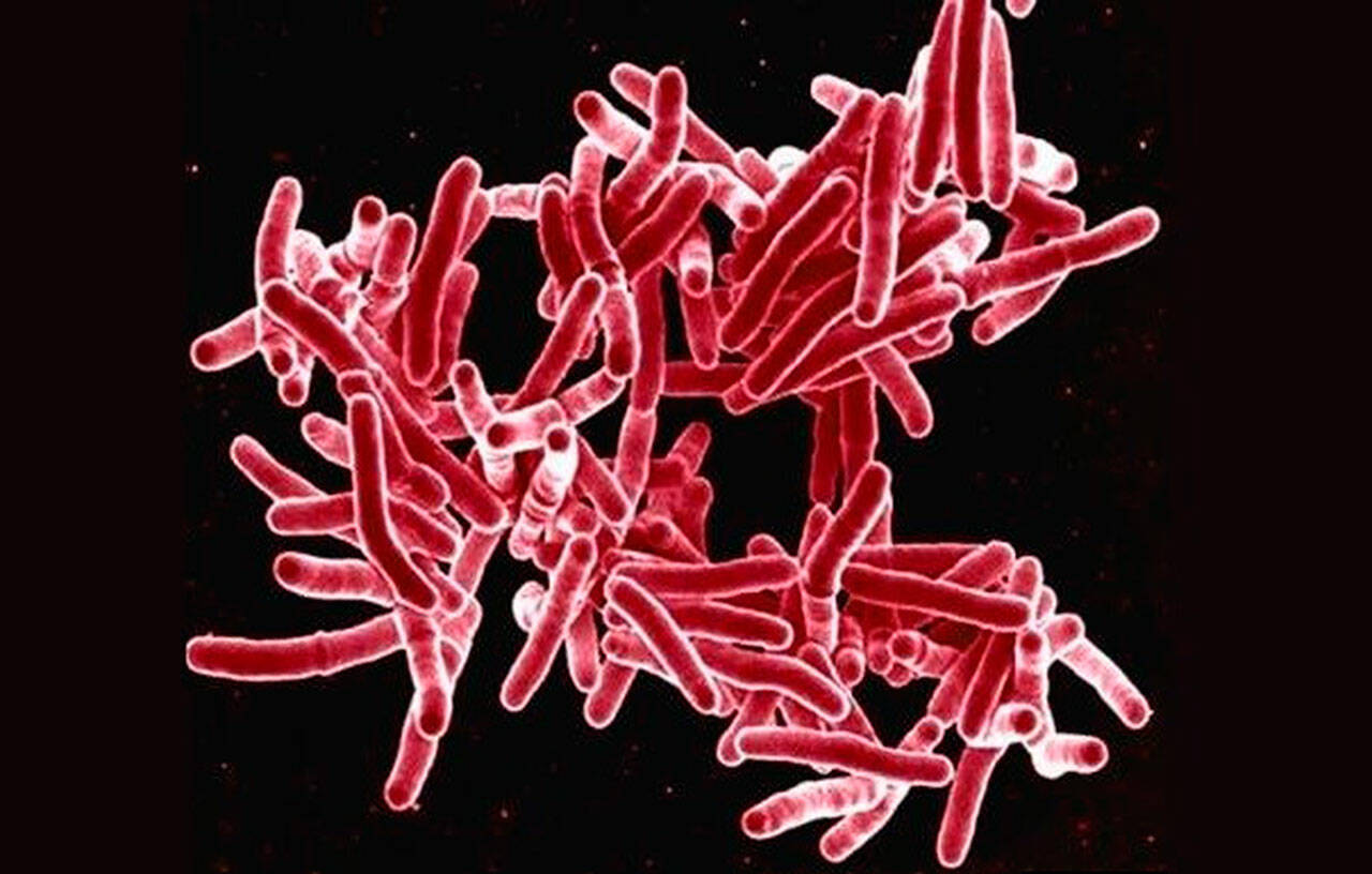 Tuberculosis bacteria (File)