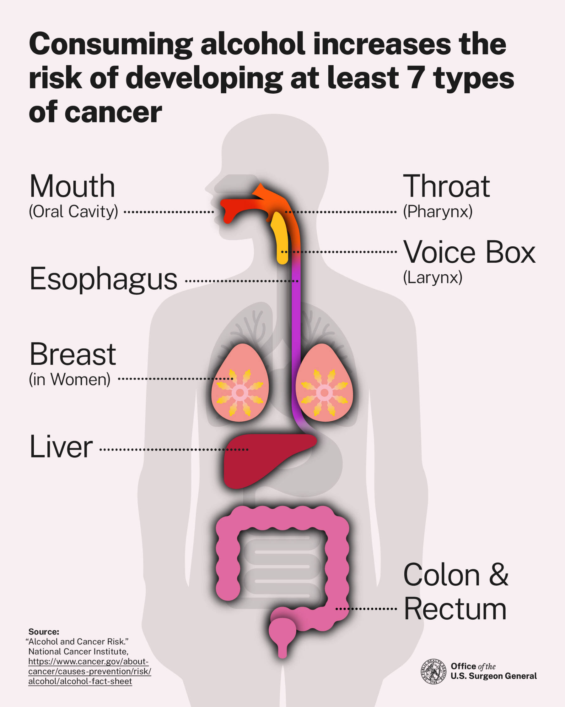 A graphic depicts cancer risks caused by alcohol consumption, according to research by the National Cancer Institute. Photo courtesy of the Office of the U.S. Surgeon General