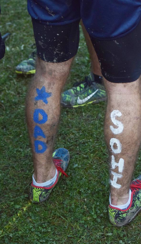 Body paint decorates the calves of Soldotna&rsquo;s Koby Vinson after the Division I boys race Saturday at the ASAA First National Bank Alaska Cross-country State Championships at Bartlett High School. (Photo by Joey Klecka/Peninsula Clarion)