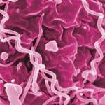 This image shows treponema pallidum, the bacteria that cause syphilis. Alaska's syphilis infection rates increased by 49% over 2019 numbers, the Department of Health and Social Services reported this week. (Courtesy Photo / NIAID)