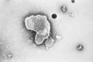 This 1981 photo provided by the Centers for Disease Control and Prevention (CDC) shows an electron micrograph of Respiratory Syncytial Virus, also known as RSV. Childrens hospitals in parts of the country are seeing a distressing surge in RSV, a common respiratory illness that can cause severe breathing problems for babies. Cases fell dramatically two years ago as the pandemic shut down schools, day cares and businesses. Then, with restrictions easing, the summer of 2021 brought an alarming increase in what is normally a fall and winter virus. (CDC via AP)